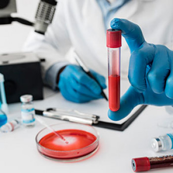 COVID-RTPCR